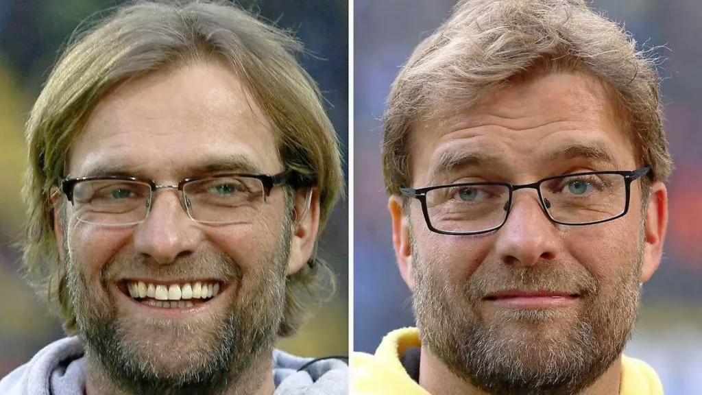 Jürgen Klopp Krankheit